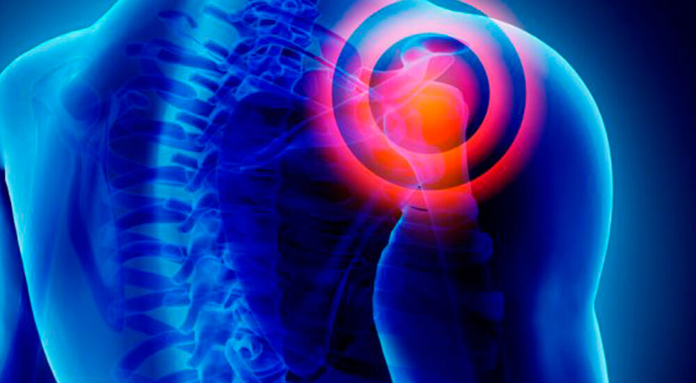 Tratamentos de Ombro Fisioterapia