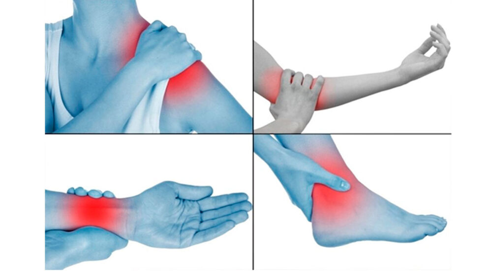 Tratamentos de Tendinite Fisioterapia